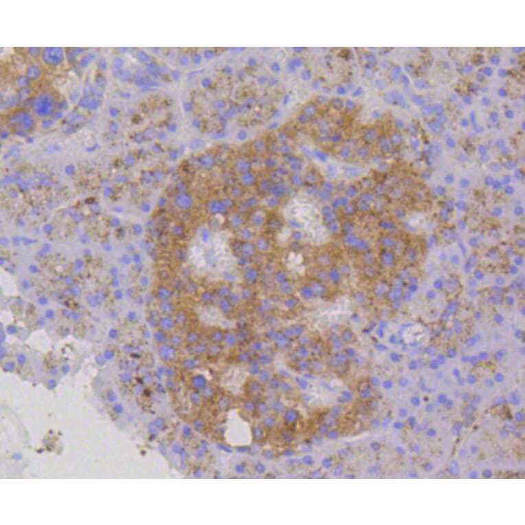 Immunohistochemistry - Anti-LAMP2 Antibody (A10954) - Antibodies.com