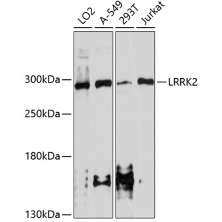 Western Blot - Anti-LRRK2 Antibody (A10959) - Antibodies.com