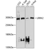 Western Blot - Anti-LRRK2 Antibody (A10959) - Antibodies.com