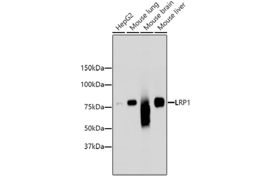 Western Blot - Anti-LRP1 Antibody (A10963) - Antibodies.com