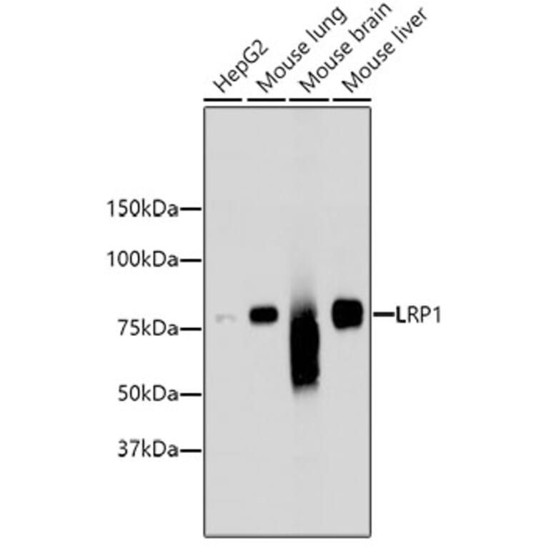 Western Blot - Anti-LRP1 Antibody (A10963) - Antibodies.com