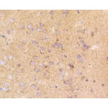 Immunohistochemistry - Anti-LRP1 Antibody (A10963) - Antibodies.com