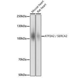 Western Blot - Anti-SERCA2 ATPase Antibody (A13169) - Antibodies.com