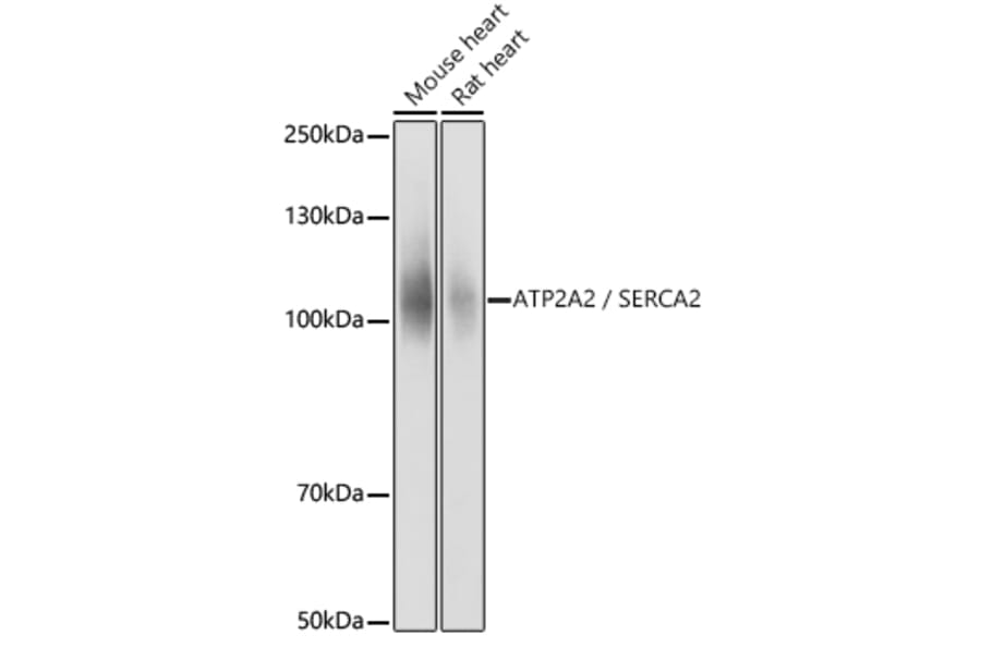 Western Blot - Anti-SERCA2 ATPase Antibody (A13169) - Antibodies.com