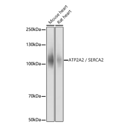 Western Blot - Anti-SERCA2 ATPase Antibody (A13169) - Antibodies.com