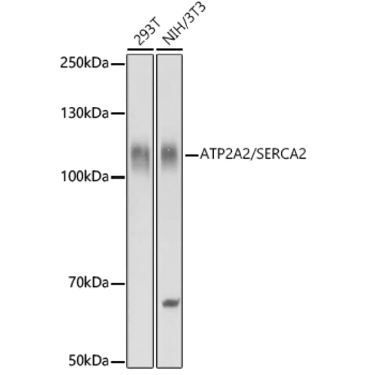 Western Blot - Anti-SERCA2 ATPase Antibody (A13169) - Antibodies.com