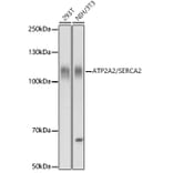 Western Blot - Anti-SERCA2 ATPase Antibody (A13169) - Antibodies.com