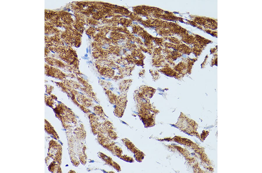 Immunohistochemistry - Anti-SERCA2 ATPase Antibody (A13169) - Antibodies.com