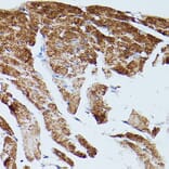 Immunohistochemistry - Anti-SERCA2 ATPase Antibody (A13169) - Antibodies.com
