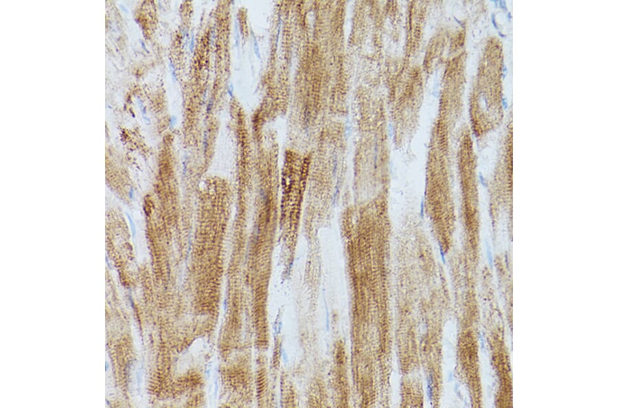Immunohistochemistry - Anti-SERCA2 ATPase Antibody (A13169) - Antibodies.com