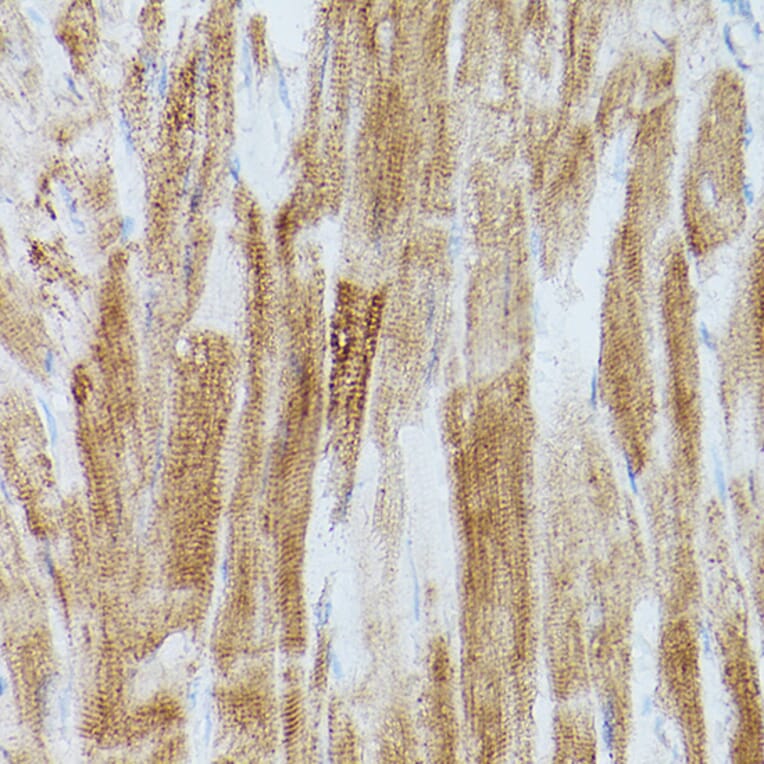 Immunohistochemistry - Anti-SERCA2 ATPase Antibody (A13169) - Antibodies.com
