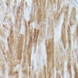 Immunohistochemistry - Anti-SERCA2 ATPase Antibody (A13169) - Antibodies.com