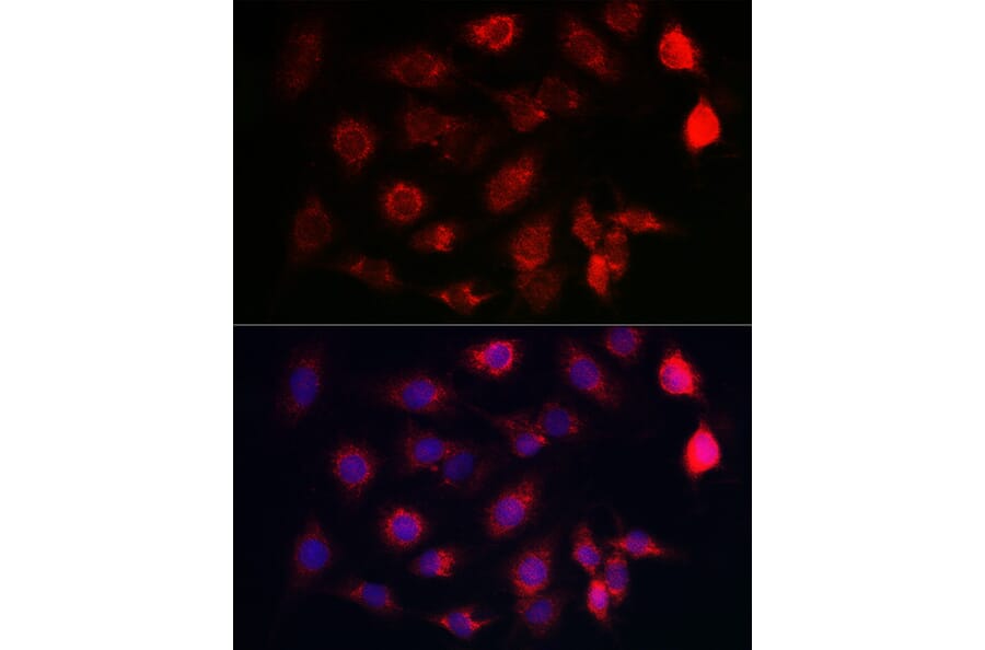 Immunofluorescence - Anti-SERCA2 ATPase Antibody (A13169) - Antibodies.com