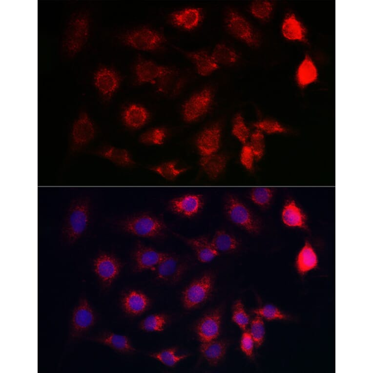 Immunofluorescence - Anti-SERCA2 ATPase Antibody (A13169) - Antibodies.com