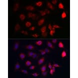 Immunofluorescence - Anti-SERCA2 ATPase Antibody (A13169) - Antibodies.com