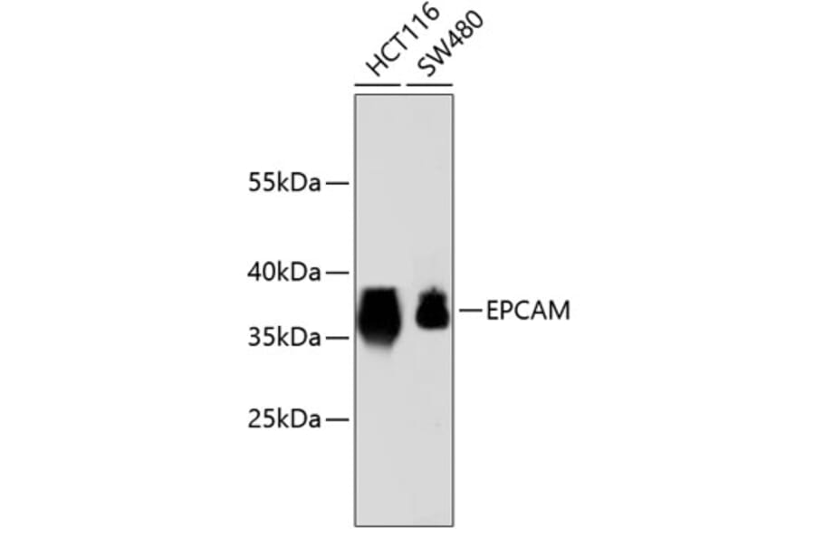 Western Blot - Anti-EPCAM Antibody (A10978) - Antibodies.com