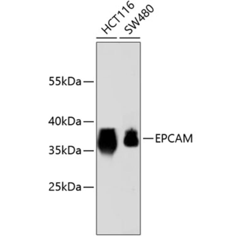Western Blot - Anti-EPCAM Antibody (A10978) - Antibodies.com