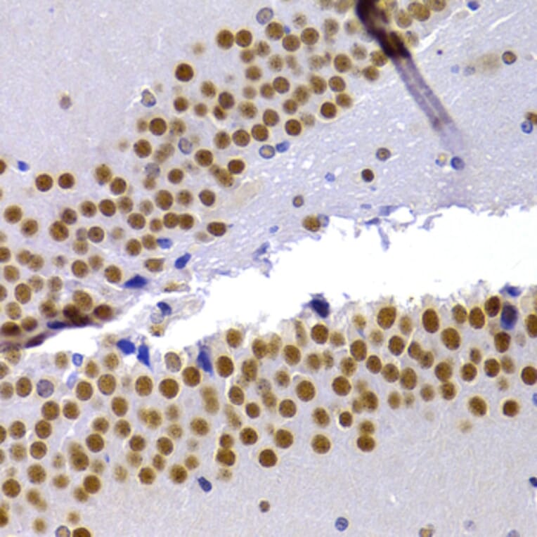 Immunohistochemistry - Anti-HP1 alpha Antibody (A13174) - Antibodies.com