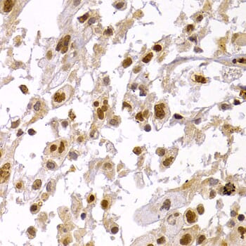 Anti-HP1 alpha Antibody (A13174) | Antibodies.com