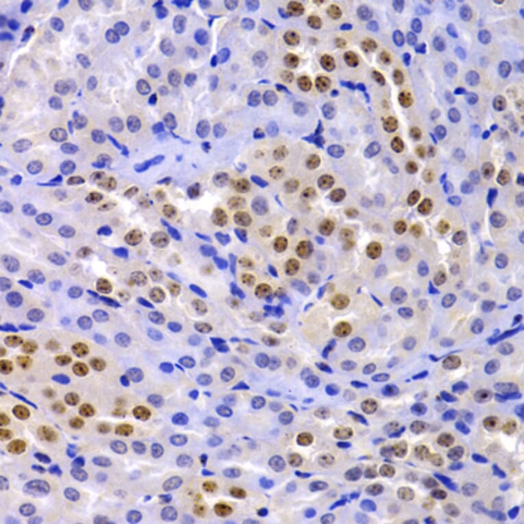 Immunohistochemistry - Anti-HP1 alpha Antibody (A13174) - Antibodies.com