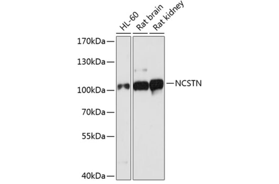Western Blot - Anti-NCSTN Antibody (A1099) - Antibodies.com