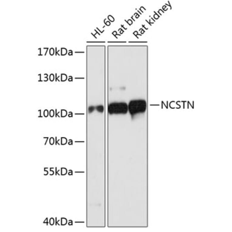 Western Blot - Anti-NCSTN Antibody (A1099) - Antibodies.com