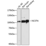 Western Blot - Anti-NCSTN Antibody (A1099) - Antibodies.com