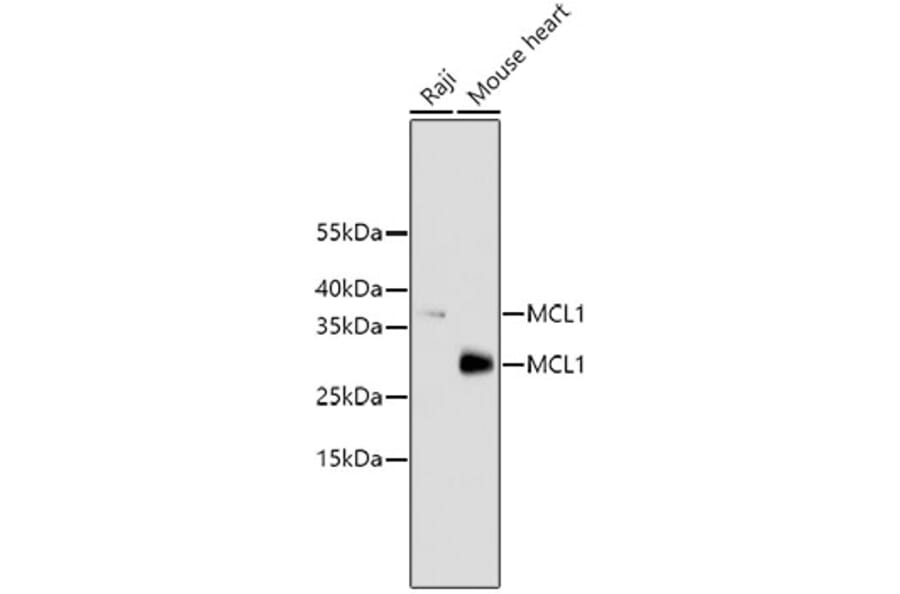 Western Blot - Anti-MCL1 Antibody (A10993) - Antibodies.com