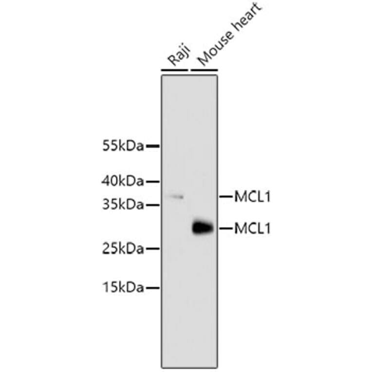 Western Blot - Anti-MCL1 Antibody (A10993) - Antibodies.com