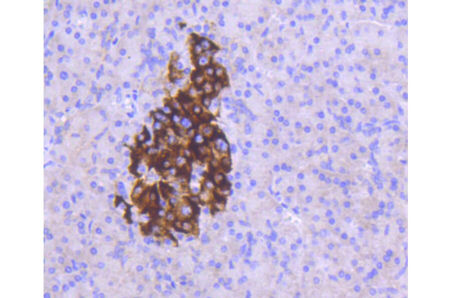 Immunohistochemistry - Anti-MCL1 Antibody (A10993) - Antibodies.com