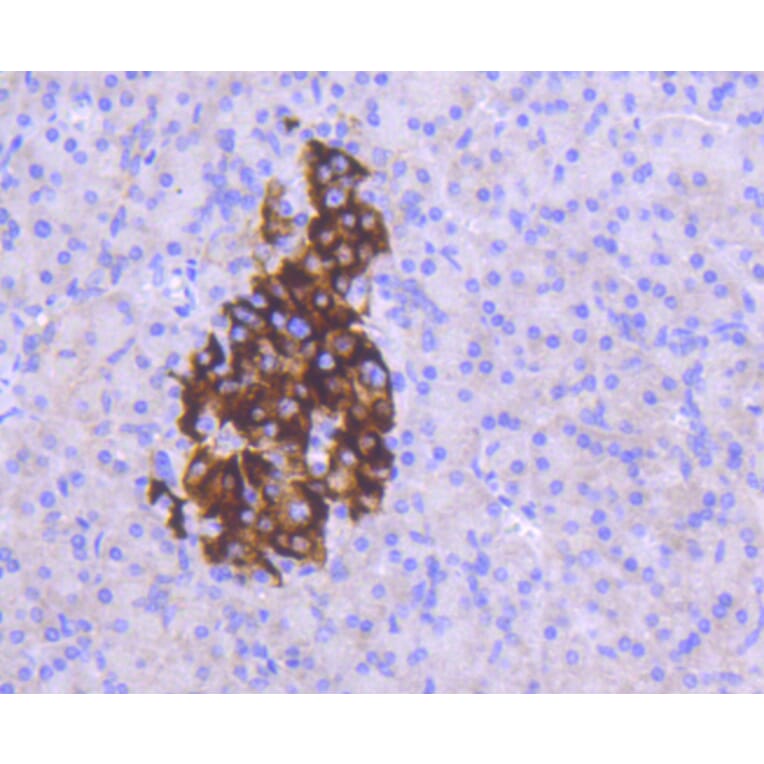 Immunohistochemistry - Anti-MCL1 Antibody (A10993) - Antibodies.com