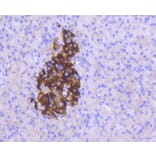 Immunohistochemistry - Anti-MCL1 Antibody (A10993) - Antibodies.com