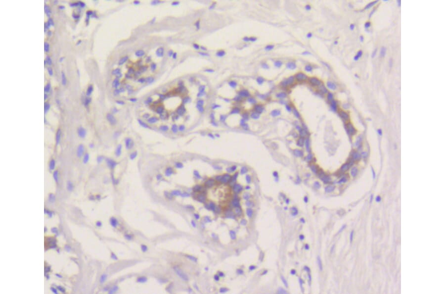 Immunohistochemistry - Anti-MCL1 Antibody (A10993) - Antibodies.com