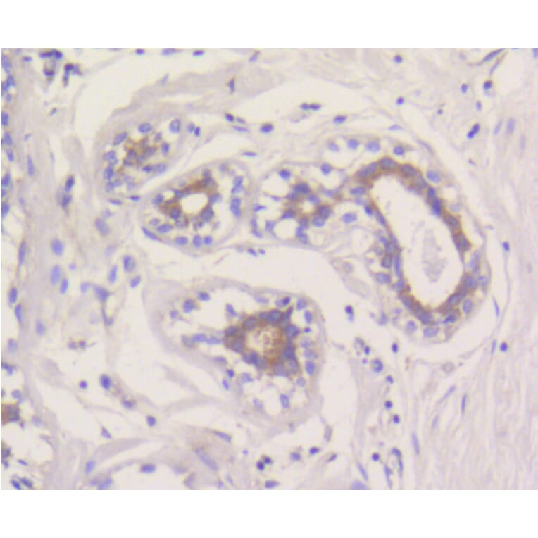 Immunohistochemistry - Anti-MCL1 Antibody (A10993) - Antibodies.com