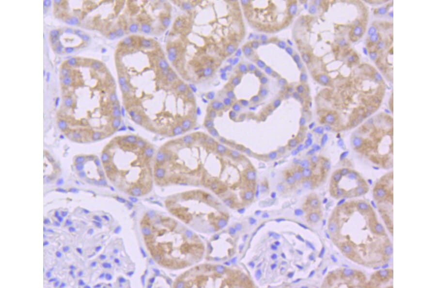 Immunohistochemistry - Anti-MCL1 Antibody (A10993) - Antibodies.com