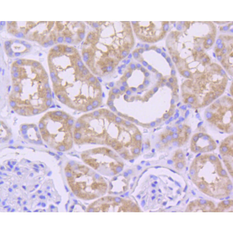 Immunohistochemistry - Anti-MCL1 Antibody (A10993) - Antibodies.com