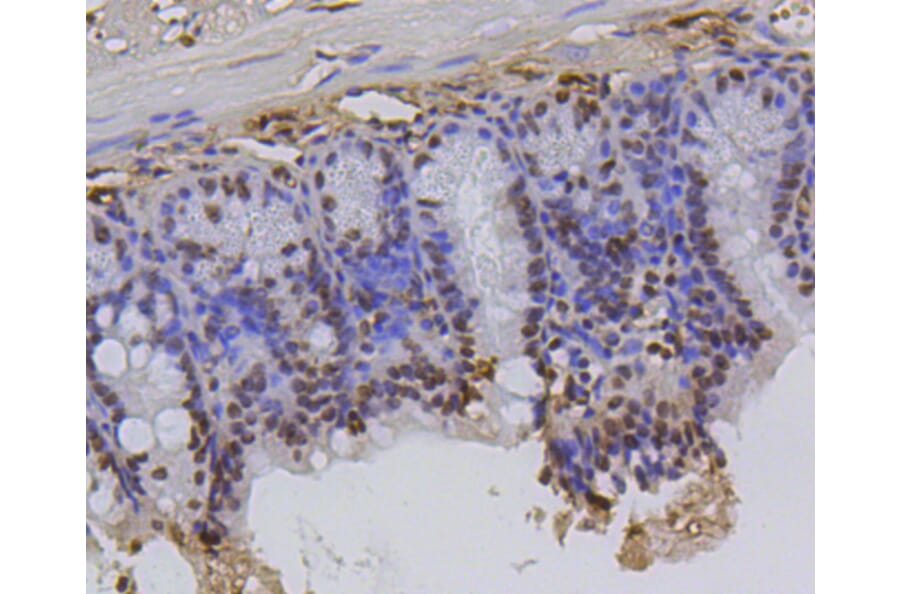 Immunohistochemistry - Anti-Hydroxyl-Histone H2A-Y39 Antibody (A11009) - Antibodies.com