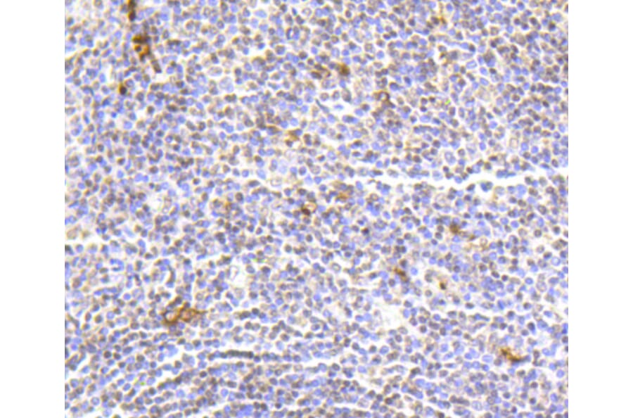 Immunohistochemistry - Anti-Hydroxyl-Histone H2A-Y39 Antibody (A11009) - Antibodies.com