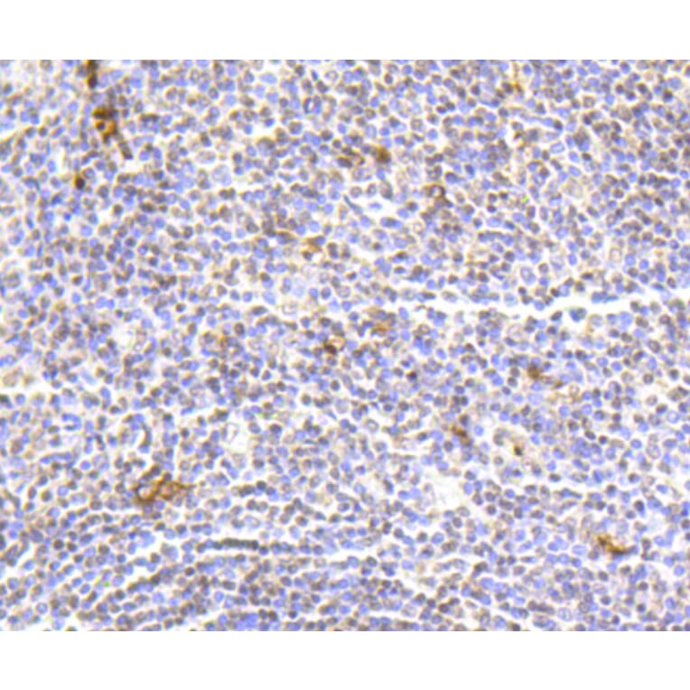 Immunohistochemistry - Anti-Hydroxyl-Histone H2A-Y39 Antibody (A11009) - Antibodies.com
