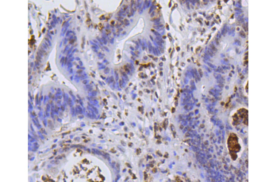 Immunohistochemistry - Anti-Hydroxyl-Histone H2A-Y39 Antibody (A11009) - Antibodies.com