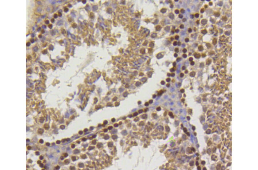 Immunohistochemistry - Anti-Hydroxyl-Histone H2A-Y39 Antibody (A11009) - Antibodies.com