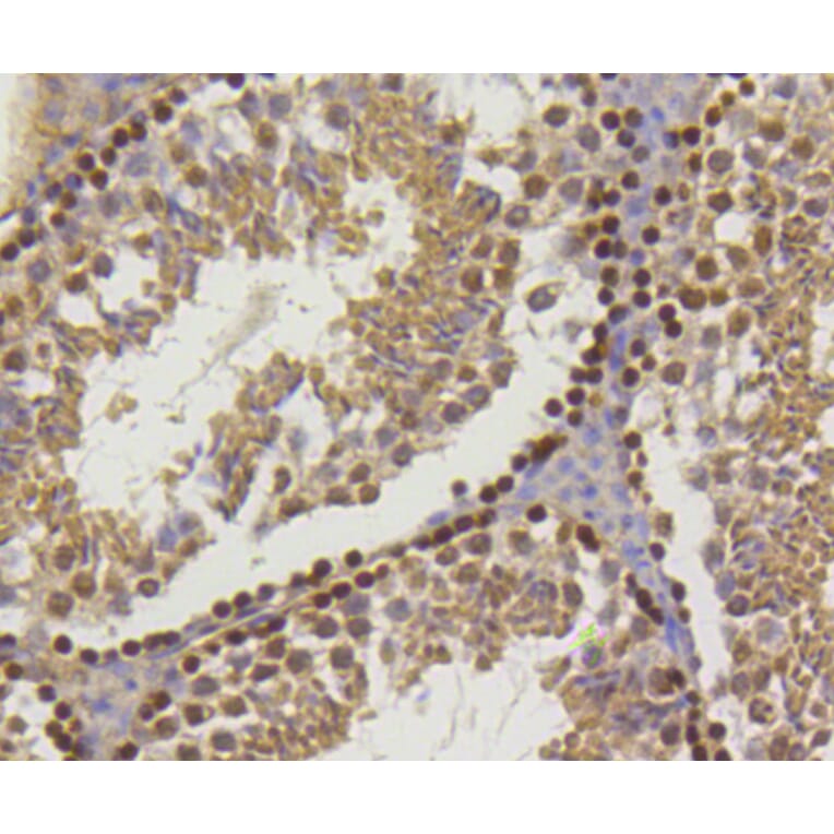 Immunohistochemistry - Anti-Hydroxyl-Histone H2A-Y39 Antibody (A11009) - Antibodies.com