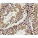 Immunohistochemistry - Anti-Hydroxyl-Histone H2A-Y39 Antibody (A11009) - Antibodies.com