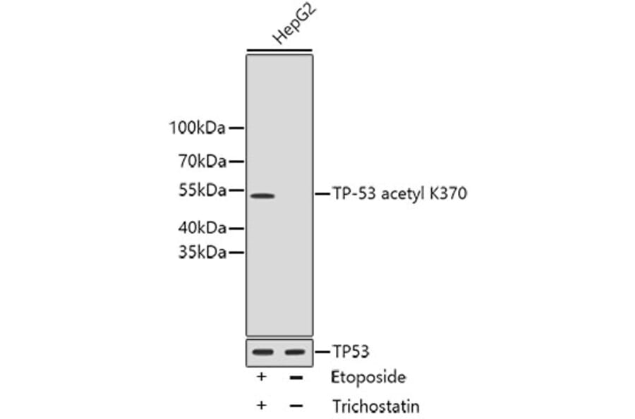 Western Blot - Anti-Acetyl-TP53-K370 mAb Antibody (A11012) - Antibodies.com