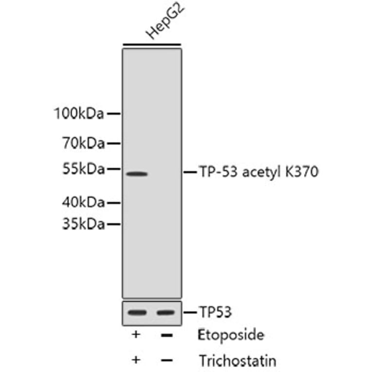 Western Blot - Anti-Acetyl-TP53-K370 mAb Antibody (A11012) - Antibodies.com