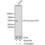 Western Blot - Anti-Acetyl-TP53-K370 mAb Antibody (A11012) - Antibodies.com