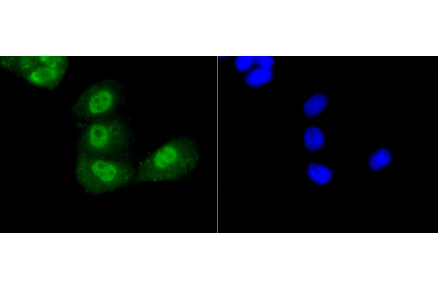 Immunofluorescence - Anti-Acetyl-TP53-K370 mAb Antibody (A11012) - Antibodies.com