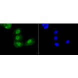 Immunofluorescence - Anti-Acetyl-TP53-K370 mAb Antibody (A11012) - Antibodies.com