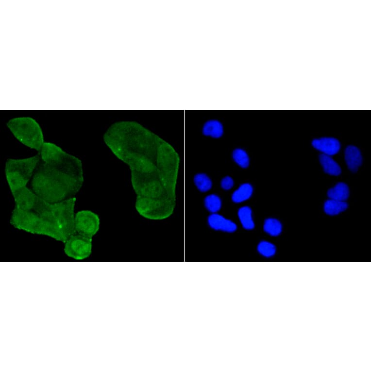 Immunofluorescence - Anti-Acetyl-TP53-K370 mAb Antibody (A11012) - Antibodies.com