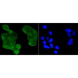 Immunofluorescence - Anti-Acetyl-TP53-K370 mAb Antibody (A11012) - Antibodies.com